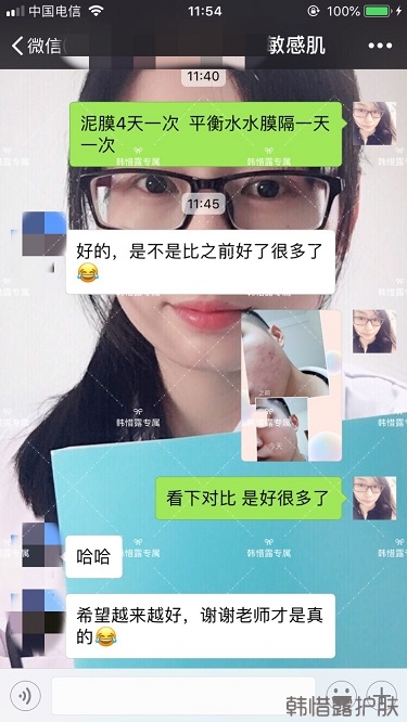 粉刺、痘痘、痘印、統統解決啦！祛痘去粉刺就是這么簡單！