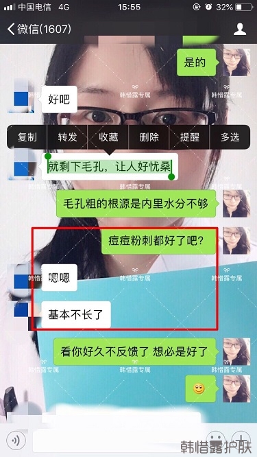 粉刺痘痘，痘印都沒(méi)了，寶媽重回顏值巔峰！