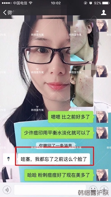 痘痘好了皮膚美麗，不想再記起曾經(jīng)滿臉痘痘的自己！
