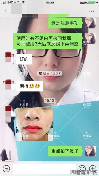 鼻子發紅長痘痘消了，皮膚吸收好就是任性！